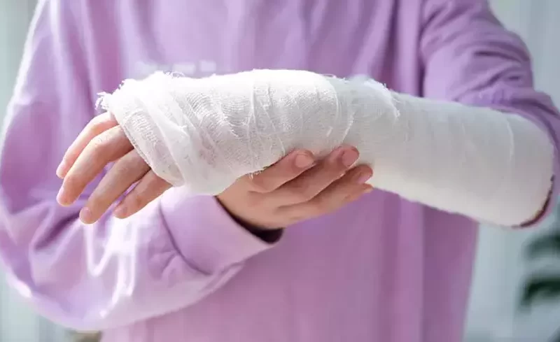  Ön kol kırıkları