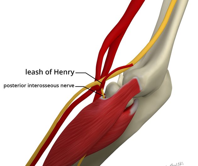 Posterior Interosseöz