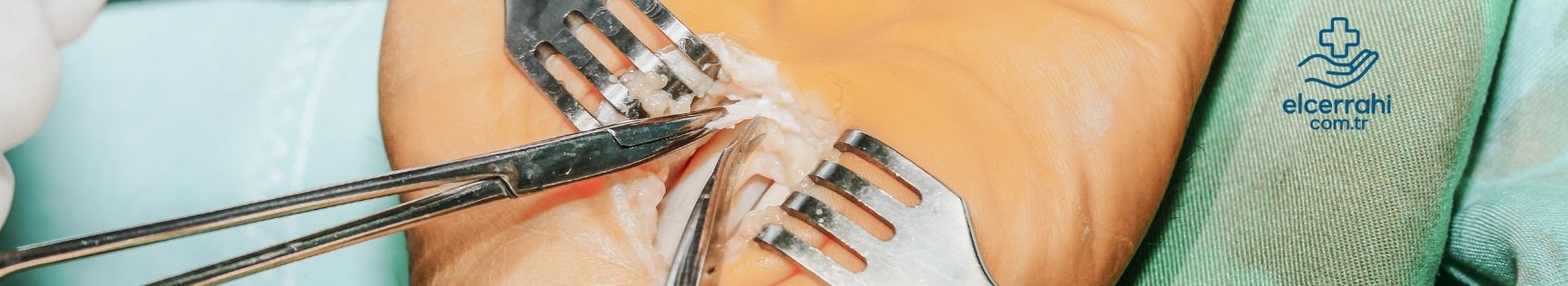 banner img