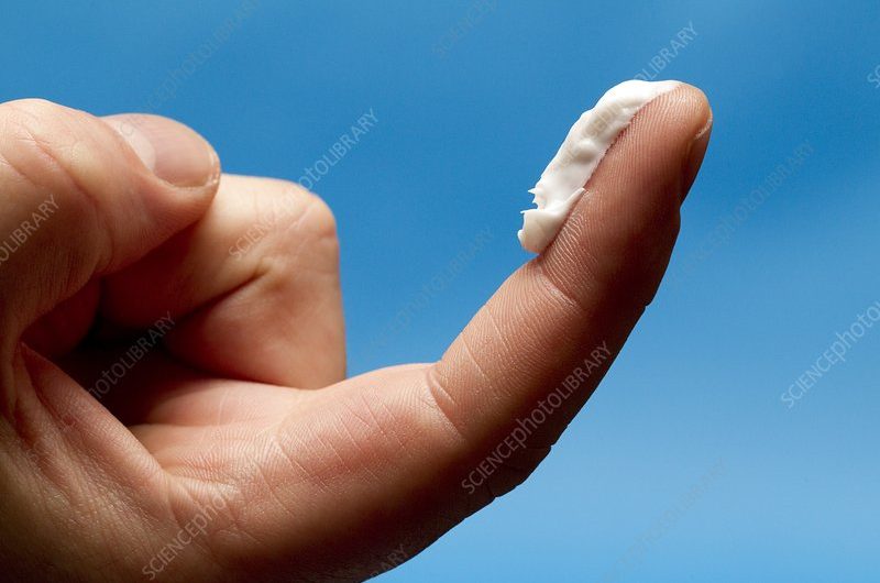 Fingertip Amputasyonlarında IDAP Flap ile Homodigital Flap Sonuçları