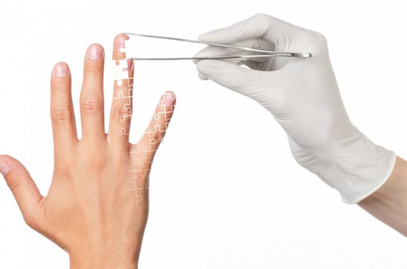 Kemik Grefti (Bone Graft) Nedir, Neden Yapılır?