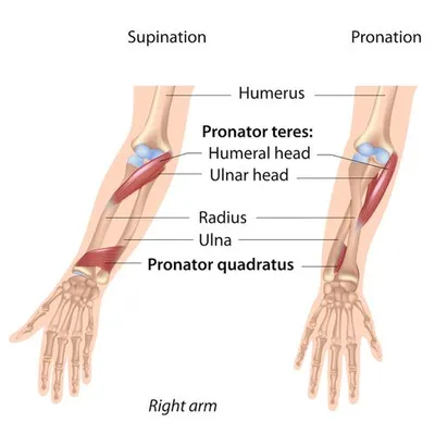 Pronator Teres Sendromu