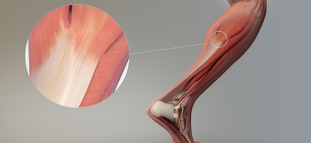 Tendon Kesilerinde İlk Yardım ve Dikkat Edilmesi Gerekenler